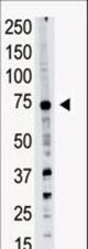 Western blot of PRDM14 polyclonal antibody in A549 cell lysate. PRDM14 (arrow) was detected using purified antibody. Secondary HRP-anti-rabbit was used for signal visualization with chemiluminescence.