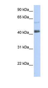 PRDM15 antibody LS-C101602 Western blot of 293T cell lysate.