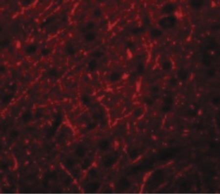 Immunofluorescence of PRDM16 in Human Brain cells with PRDM16 antibody at 20 ug/ml.