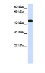 Transfected 293T cell lysate. Antibody concentration: 1.0 ug/ml. Gel concentration: 12%.