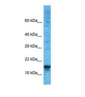 Western blot of Human ACHN. PRDM5 antibody dilution 1.0 ug/ml.