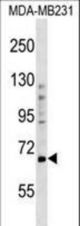 PRDM5 Antibody western blot of MDA-MB231 cell line lysates (35 ug/lane). The PRDM5 antibody detected the PRDM5 protein (arrow).