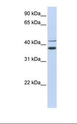 Hela cell lysate. Antibody concentration: 1.0 ug/ml. Gel concentration: 12%.