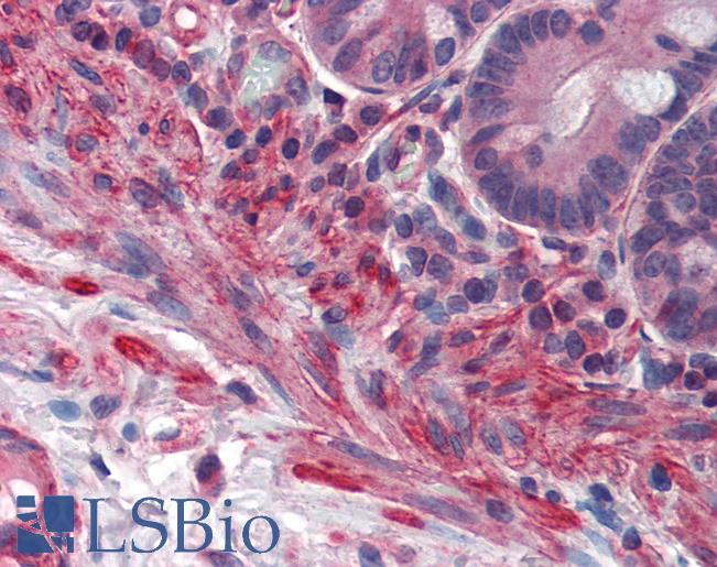 Anti-PRDM5 antibody IHC of human small intestine. Immunohistochemistry of formalin-fixed, paraffin-embedded tissue after heat-induced antigen retrieval. Antibody LS-B3500 concentration 5 ug/ml.