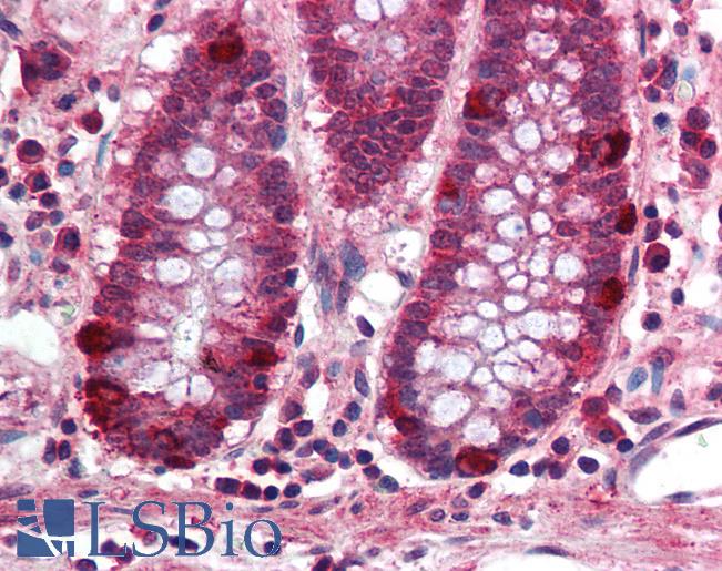Anti-PRDM5 antibody IHC of human colon. Immunohistochemistry of formalin-fixed, paraffin-embedded tissue after heat-induced antigen retrieval. Antibody LS-B1982 concentration 5 ug/ml.