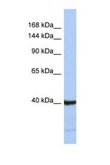 Western blot of Human Jurkat. PRDM6 antibody dilution 1.0 ug/ml.