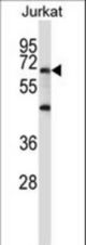 PRDM6 Antibody western blot of Jurkat cell line lysates (35 ug/lane). The PRDM6 antibody detected the PRDM6 protein (arrow).
