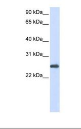 293T cell lysate. Antibody concentration: 1.0 ug/ml. Gel concentration: 12%.