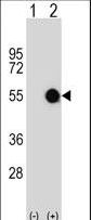 Western blot of MKRN2 (arrow) using rabbit polyclonal MKRN2 Antibody. 293 cell lysates (2 ug/lane) either nontransfected (Lane 1) or transiently transfected (Lane 2) with the MKRN2 gene.