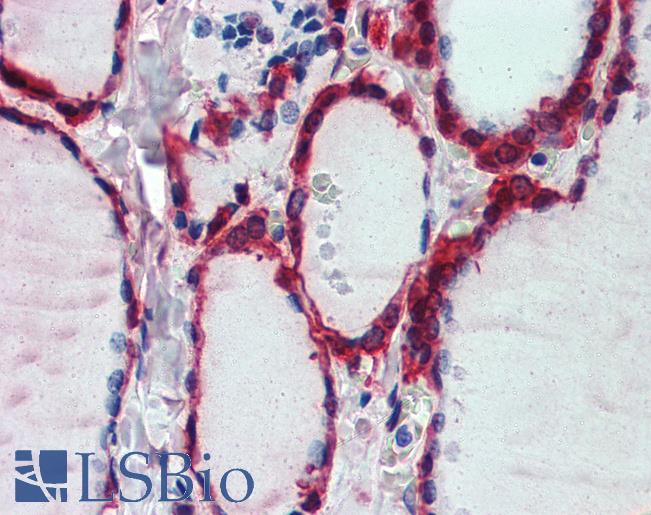 Anti-PRDX1 / Peroxiredoxin 1 antibody IHC of human thyroid. Immunohistochemistry of formalin-fixed, paraffin-embedded tissue after heat-induced antigen retrieval. Antibody LS-B3966 concentration 2.5 ug/ml.
