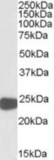 Antibody (0.01 ug/ml) staining of HepG2 lysate (35 ug protein in RIPA buffer). Primary incubation was 1 hour. Detected by chemiluminescence.