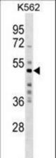 MKRN2 Antibody western blot of K562 cell line lysates (35 ug/lane). The MKRN2 antibody detected the MKRN2 protein (arrow).