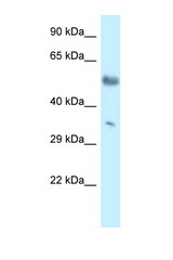 MKX antibody LS-C145596 Western blot of Mouse Brain lysate. Antibody concentration 1 ug/ml.