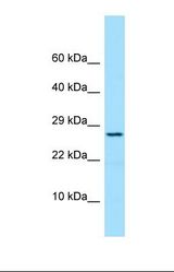 Western blot of Human COLO205. PRDX4 antibody dilution 1.0 ug/ml.
