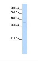 Jurkat cell lysate. Antibody concentration: 0.5 ug/ml. Gel concentration: 12%.