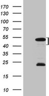 HEK293T cells were transfected with the pCMV6-ENTRY control (Left lane) or pCMV6-ENTRY MKX (Right lane) cDNA for 48 hrs and lysed. Equivalent amounts of cell lysates (5 ug per lane) were separated by SDS-PAGE and immunoblotted with anti-MKX (1:2000).