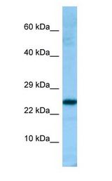 PRDX4 / Peroxiredoxin 4 antibody Western Blot of Fetal Heart.