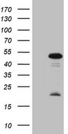 HEK293T cells were transfected with the pCMV6-ENTRY control (Left lane) or pCMV6-ENTRY MKX (Right lane) cDNA for 48 hrs and lysed. Equivalent amounts of cell lysates (5 ug per lane) were separated by SDS-PAGE and immunoblotted with anti-MKX (1:2000).