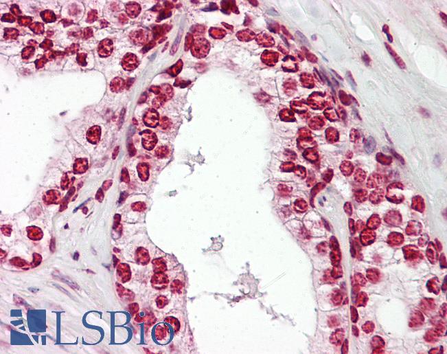 Anti-MKX antibody IHC of human prostate. Immunohistochemistry of formalin-fixed, paraffin-embedded tissue after heat-induced antigen retrieval. Antibody LS-B8063 dilution 2.5-5 ug/ml.