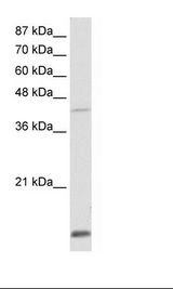 Transfected 293T Cell Lysate