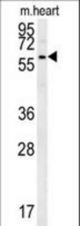 PRELP Antibody western blot of mouse heart tissue lysates (15 ug/lane). The PRELP antibody detected PRELP protein (arrow).
