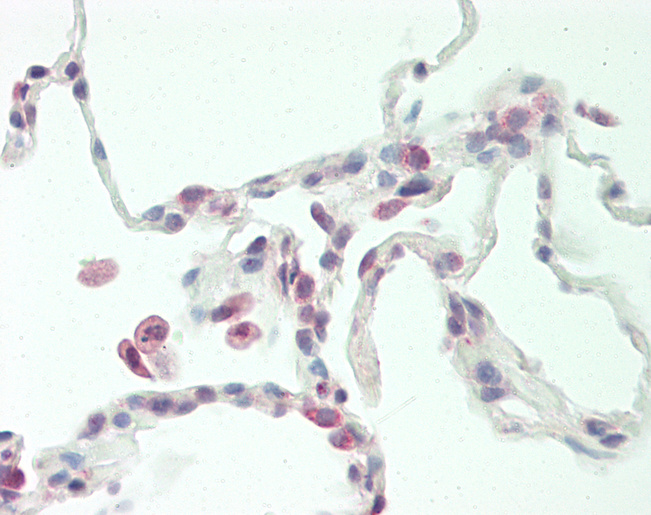 Human Lung: Formalin-Fixed, Paraffin-Embedded (FFPE)
