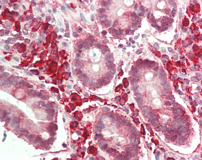 Human Small Intestine: Formalin-Fixed, Paraffin-Embedded (FFPE)