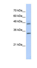 PRELP antibody LS-C102702 Western blot of Transfected 293T cell lysate.