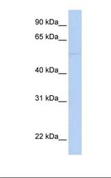 MCF7 cell lysate. Antibody concentration: 1.0 ug/ml. Gel concentration: 12%.