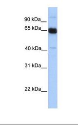 Fetal muscle lysate. Antibody concentration: 1.0 ug/ml. Gel concentration: 12%.