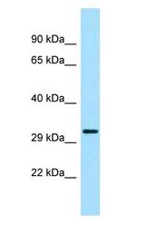 PRKAB2 / AMPK Beta 2 antibody Western Blot of Rat Muscle.