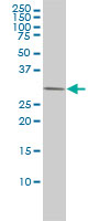 PRKAB2 monoclonal antibody (M01), clone 2G9 Western Blot analysis of PRKAB2 expression in HeLa.