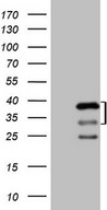HEK293T cells were transfected with the pCMV6-ENTRY control (Left lane) or pCMV6-ENTRY PRKAB2 (Right lane) cDNA for 48 hrs and lysed. Equivalent amounts of cell lysates (5 ug per lane) were separated by SDS-PAGE and immunoblotted with anti-PRKAB2 (1:2000).