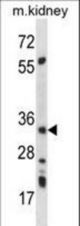 PRKAB2 Antibody (A18) western blot of mouse kidney tissue lysates (35 ug/lane). The PRKAB2 antibody detected the PRKAB2 protein (arrow).