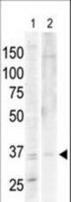 The anti-PKA/C alpha/beta antibody is used in Western blot to detect PKA/C alpha in Jurkat cell lysate (lane 1) and mouse heart tissue lysate (lane 2).