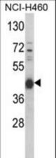 Western blot of PRKACA Antibody (N-term K82) in NCI-H460 cell line lysates (35 ug/lane). PRKACA (arrow) was detected using the purified antibody.
