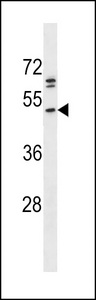 The anti-PRKACB antibody is used in Western blot to detect PRKACB in A375 cell lysate.