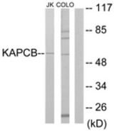 Western blot of extracts from Jurkat/COLO205 cells, using KAPCB Antibody. The lane on the right is treated with the synthesized peptide.