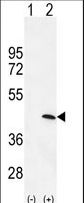 Western blot of PRKAG1 (arrow) using rabbit polyclonal PRKAG1 Antibody. 293 cell lysates (2 ug/lane) either nontransfected (Lane 1) or transiently transfected (Lane 2) with the PRKAG1 gene.