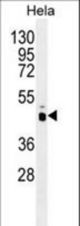 PRKAG1 Antibody western blot of HeLa cell line lysates (35 ug/lane). The PRKAG1 antibody detected the PRKAG1 protein (arrow).