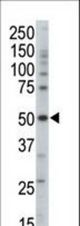 Western blot of anti-PRKAG3 antibody in mouse brain tissue lysate. PRKAG3 (arrow) was detected using purified antibody. Secondary HRP-anti-rabbit was used for signal visualization with chemiluminescence.