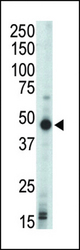 Western blot of anti-PRKAR1B antibody in mouse liver tissue lysate. PRKAR1B (arrow) was detected using purified antibody. Secondary HRP-anti-rabbit was used for signal visualization with chemiluminescence.