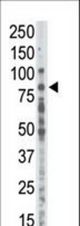 Western blot of anti-PKCalpha antibody in placenta lysate. PKCalpha (arrow) was detected using purified antibody. Secondary HRP-anti-rabbit was used for signal visualization with chemiluminescence.