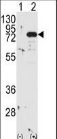 Western blot of PRKCB (arrow) using PKC beta1/2 Antibody. 293 cell lysates (2 ug/lane) either nontransfected (Lane 1) or transiently transfected with the PRKCB gene (Lane 2) (Origene Technologies).