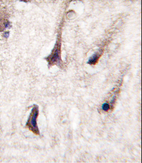 Formalin-fixed and paraffin-embedded human brain tissue reacted with PKC beta2 antibody , which was peroxidase-conjugated to the secondary antibody, followed by DAB staining. This data demonstrates the use of this antibody for immunohistochemistry; clinical relevance has not been evaluated.