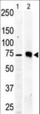 The anti-PKC beta2 antibody is used in Western blot to detect PKC beta2 in Jurkat cell lysate (lane 1) and mouse brain tissue lysate (lane 2).