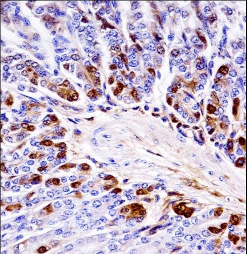 Mouse Prkcb Antibody immunohistochemistry of formalin-fixed and paraffin-embedded mouse stomach tissue followed by peroxidase-conjugated secondary antibody and DAB staining.