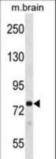 Mouse Prkcb Antibody western blot of mouse brain tissue lysates (35 ug/lane). The Prkcb antibody detected the Prkcb protein (arrow).