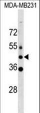 MLC1 Antibody western blot of MDA-MB231 cell line lysates (35 ug/lane). The MLC1 antibody detected the MLC1 protein (arrow).