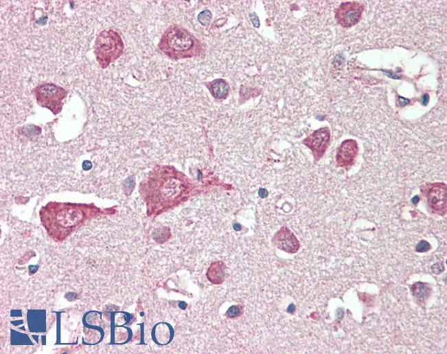 Anti-MLC1 / MLC antibody IHC staining of human brain, cortex. Immunohistochemistry of formalin-fixed, paraffin-embedded tissue after heat-induced antigen retrieval. Antibody LS-B10516 concentration 5 ug/ml.
